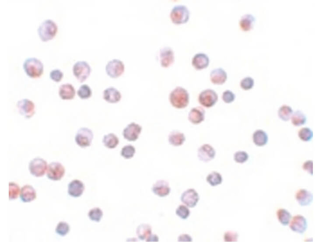 FOXO1 Antibody in Immunocytochemistry (ICC/IF)