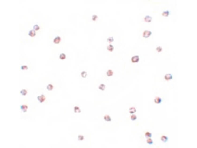 FOXO3 Antibody in Immunocytochemistry (ICC/IF)