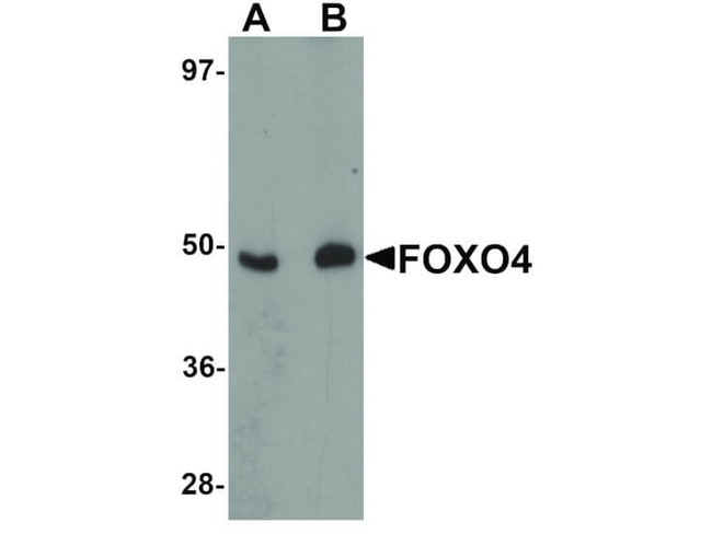 FOXO4 Antibody in Western Blot (WB)