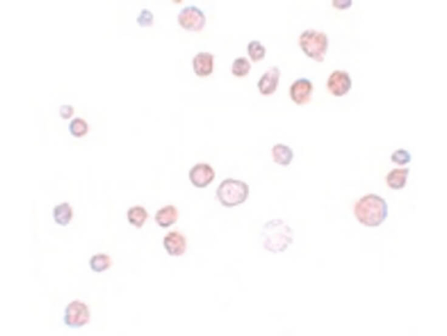 FREM1 Antibody in Immunocytochemistry (ICC/IF)