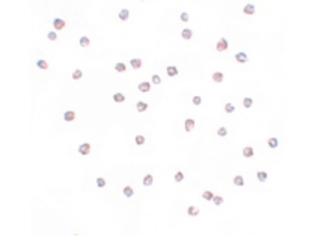 FREM2 Antibody in Immunocytochemistry (ICC/IF)