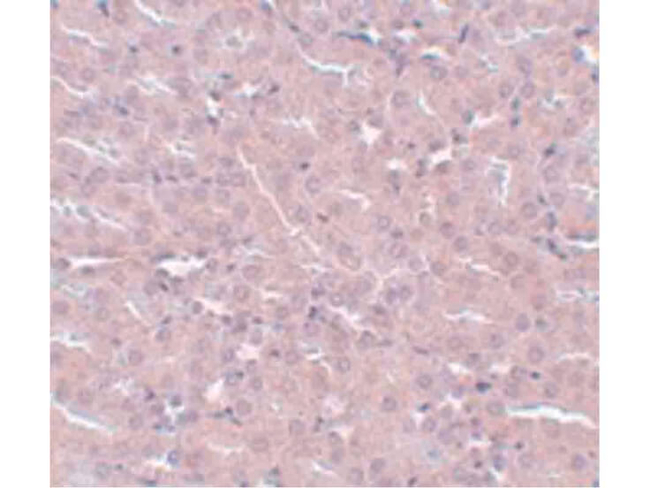 FRMPD2 Antibody in Immunohistochemistry (Paraffin) (IHC (P))