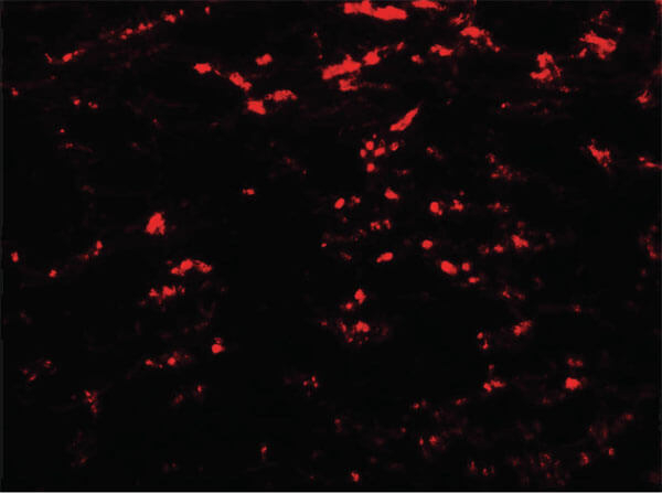 GABARAPL2 Antibody in Immunocytochemistry (ICC/IF)