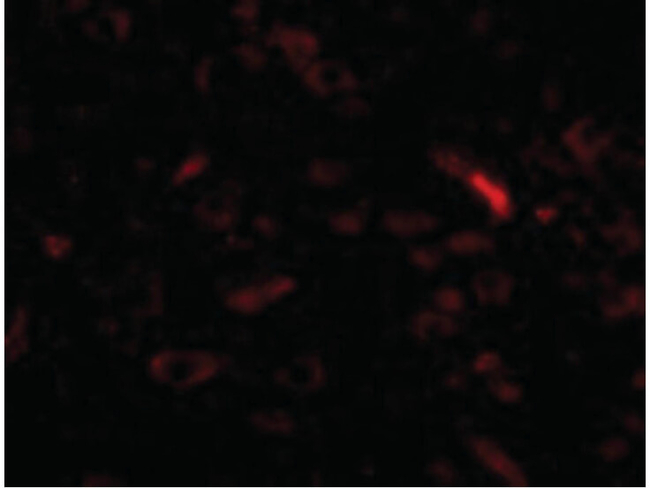 GALNT10 Antibody in Immunocytochemistry (ICC/IF)