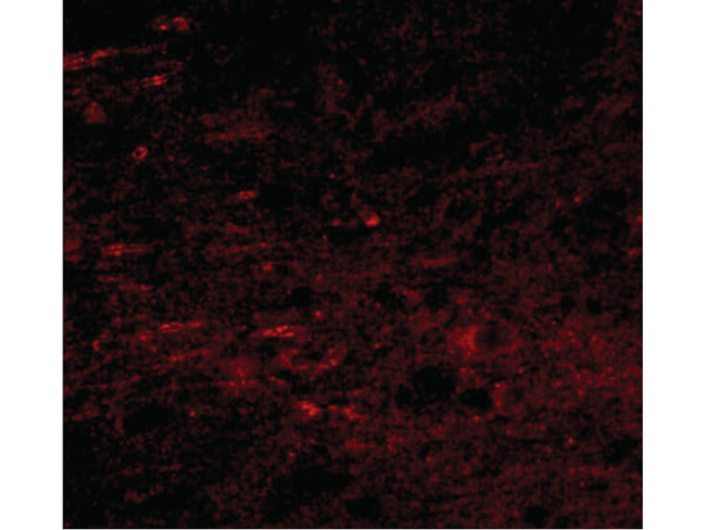 GALNT10 Antibody in Immunocytochemistry (ICC/IF)