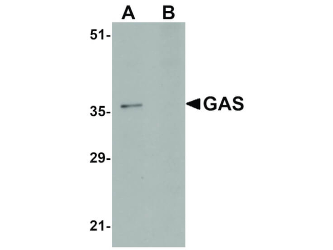 GAS Antibody in Western Blot (WB)