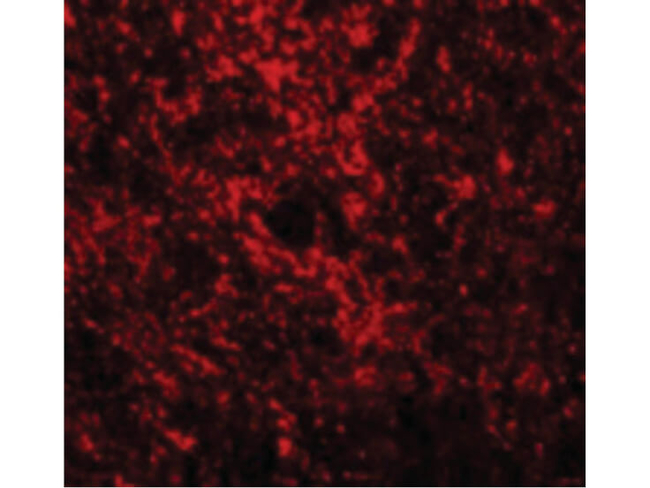 GATA3 Antibody in Immunocytochemistry (ICC/IF)