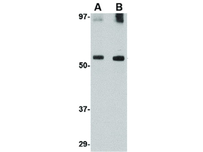 GDF6 Antibody in Western Blot (WB)