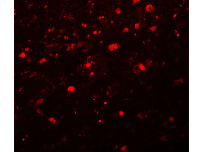 Girdin Antibody in Immunocytochemistry (ICC/IF)
