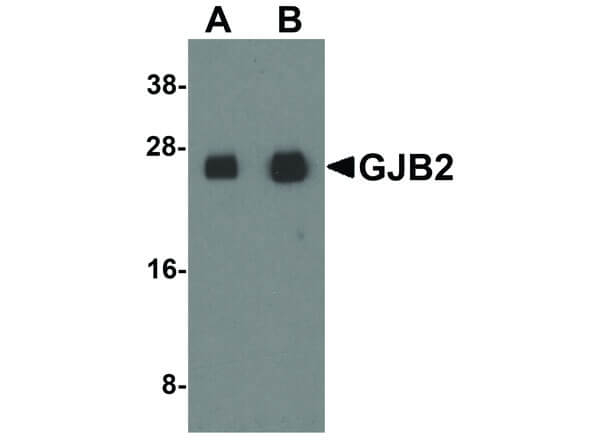 GJB2 Antibody in Western Blot (WB)