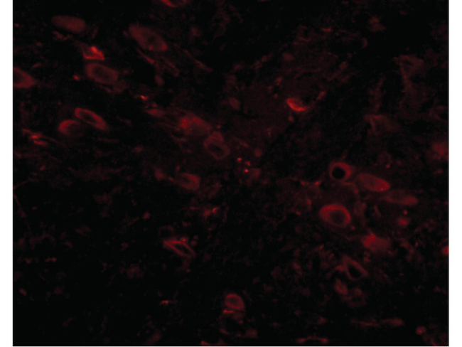 GLE1 Antibody in Immunocytochemistry (ICC/IF)