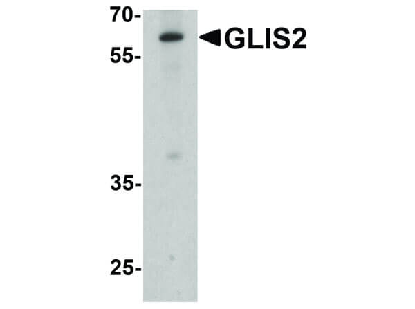 GLIS2 Antibody in Western Blot (WB)