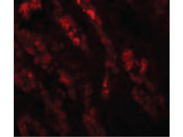 GLS2 Antibody in Immunocytochemistry (ICC/IF)