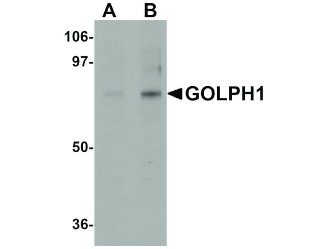 GOLPH1 Antibody in Western Blot (WB)