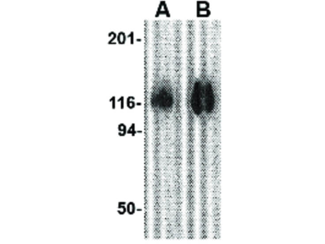 gp120 Antibody in Western Blot (WB)