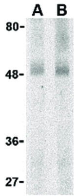 GPR15 Antibody in Western Blot (WB)