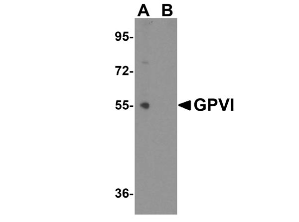 GPVI Antibody in Western Blot (WB)