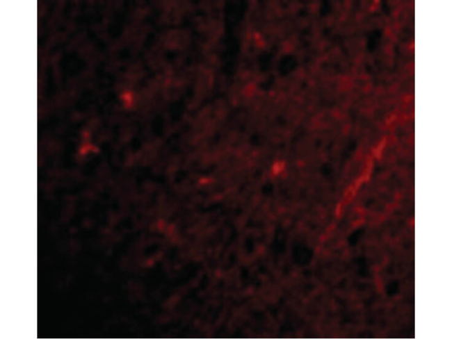 GRIK1 Antibody in Immunocytochemistry (ICC/IF)