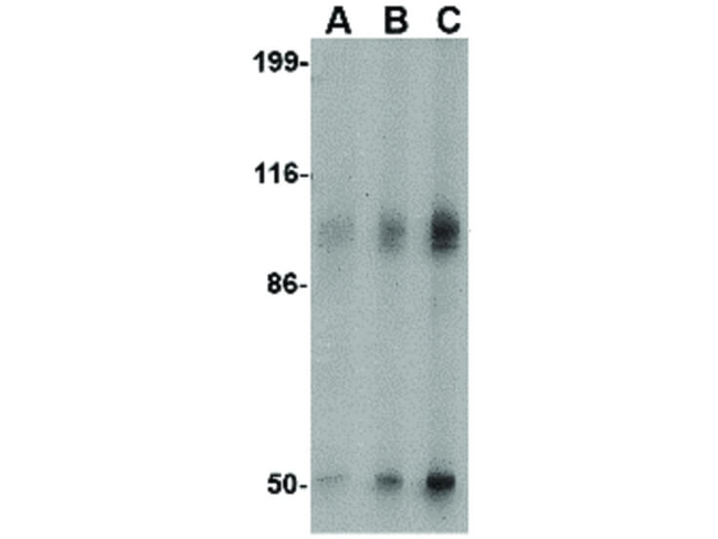 GRIK2 Antibody in Western Blot (WB)