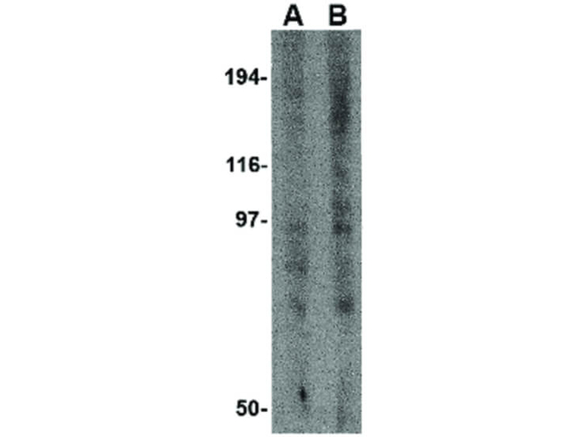 GRIK3 Antibody in Western Blot (WB)