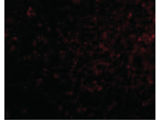 GRIK4 Antibody in Immunocytochemistry (ICC/IF)