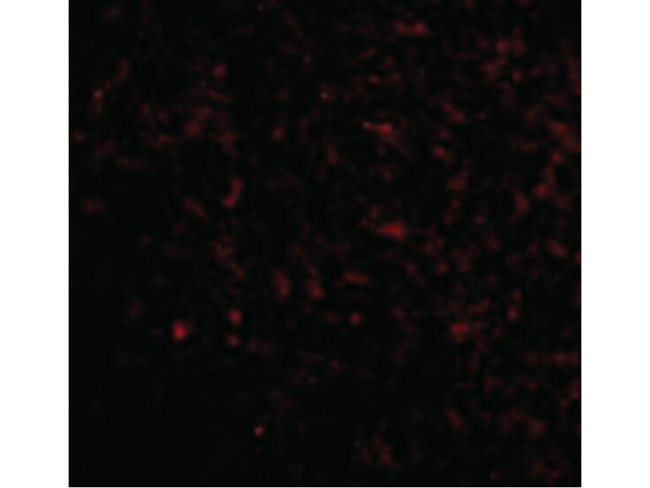 GRIK5 Antibody in Immunocytochemistry (ICC/IF)