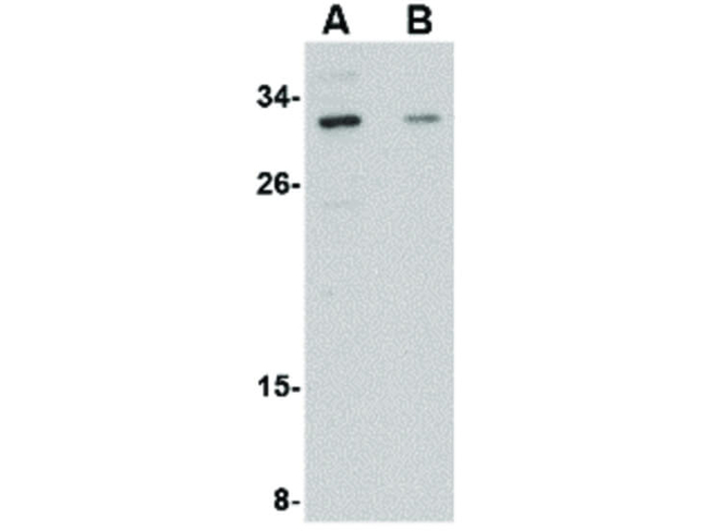 GRTP1 Antibody in Western Blot (WB)