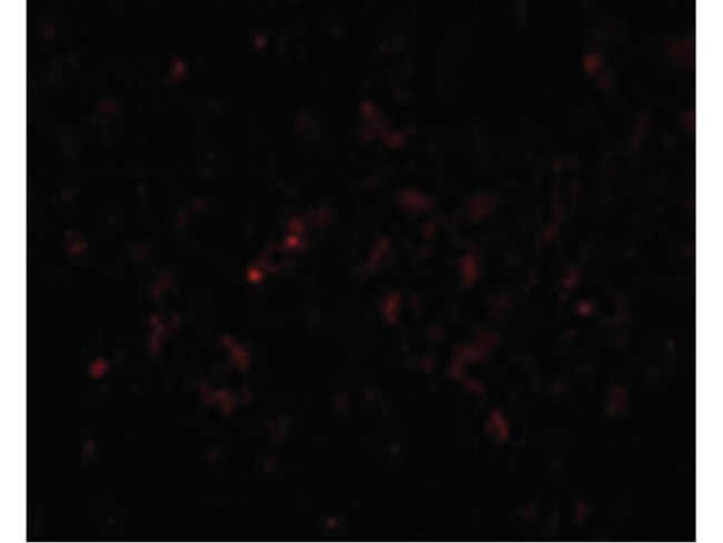 GSTP1 Antibody in Immunocytochemistry (ICC/IF)