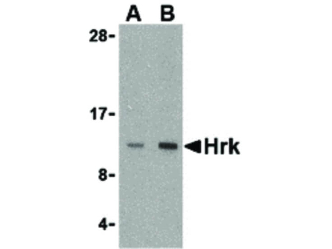 HRK Antibody in Western Blot (WB)