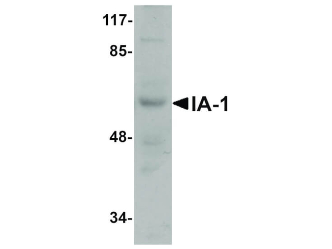 IA1 Antibody in Western Blot (WB)