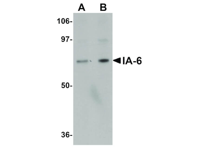 IA6 Antibody in Western Blot (WB)