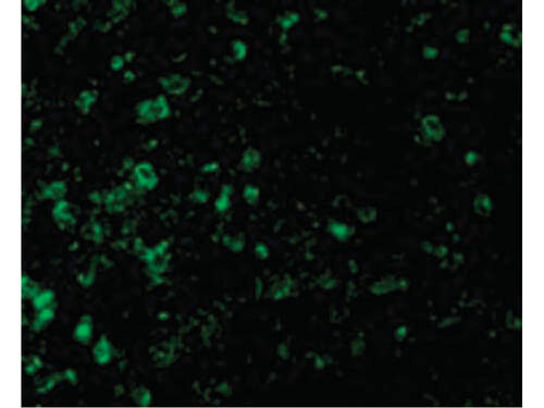 ICAD Antibody in Immunocytochemistry (ICC/IF)