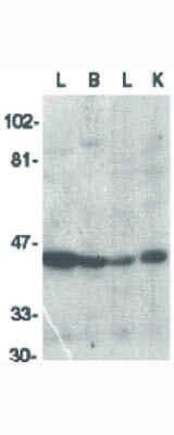 ICAD Antibody in Western Blot (WB)