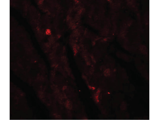 IDH2 Antibody in Immunocytochemistry (ICC/IF)