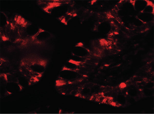 IFIT1 Antibody in Immunocytochemistry (ICC/IF)