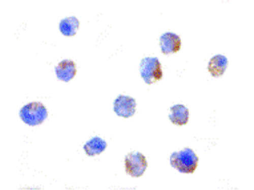 IKAP Antibody in Immunocytochemistry (ICC/IF)