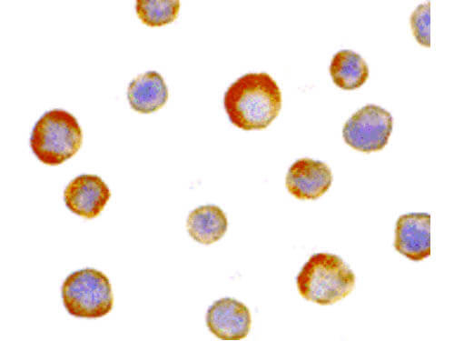 IKK gamma Antibody in Immunocytochemistry (ICC/IF)