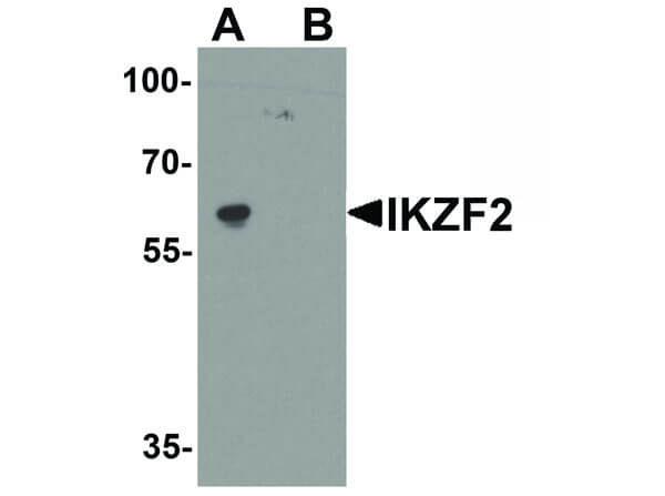 IKZF2 Antibody in Western Blot (WB)