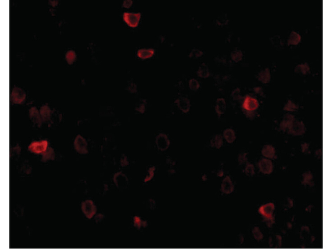 IL-16 Antibody in Immunocytochemistry (ICC/IF)