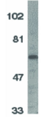 IL-1RAcP Antibody in Western Blot (WB)
