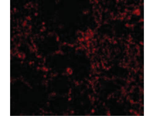 IL-21 Receptor Antibody in Immunocytochemistry (ICC/IF)