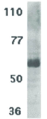 IL-21 Receptor Antibody in Western Blot (WB)