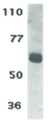 IL-22 Receptor Antibody in Western Blot (WB)