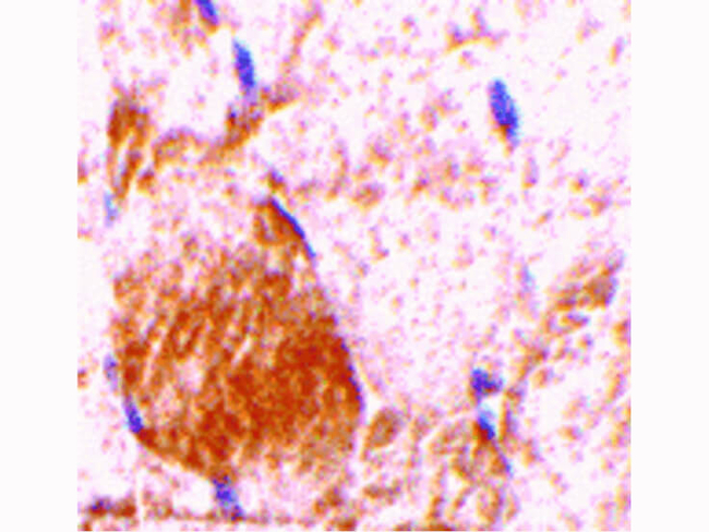 IL-31 Antibody in Immunohistochemistry (Paraffin) (IHC (P))