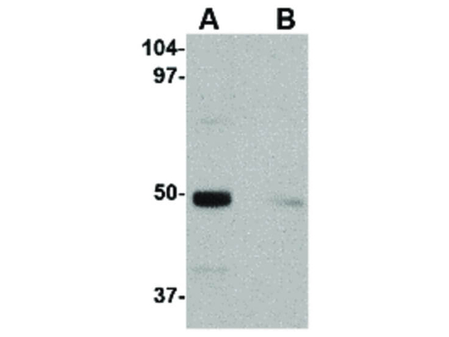 IL-34 Antibody in Western Blot (WB)