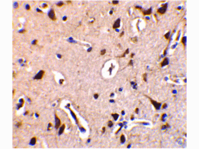 ILPIP Antibody in Immunohistochemistry (Paraffin) (IHC (P))