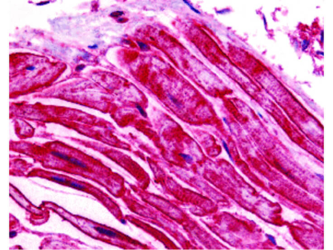 ILPIP Antibody in Immunohistochemistry (Paraffin) (IHC (P))