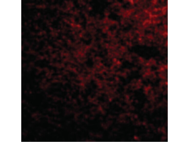 IPR1 Antibody in Immunocytochemistry (ICC/IF)