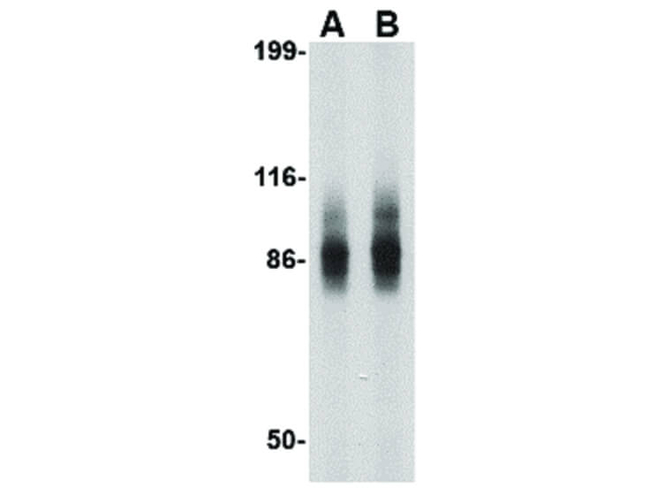 IPR1 Antibody in Western Blot (WB)