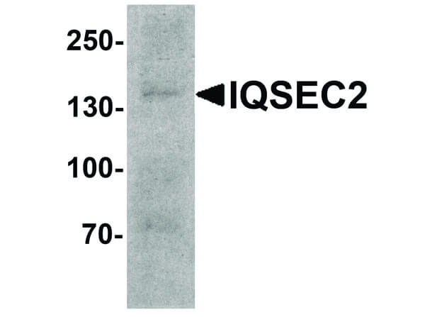 IQSEC2 Antibody in Western Blot (WB)